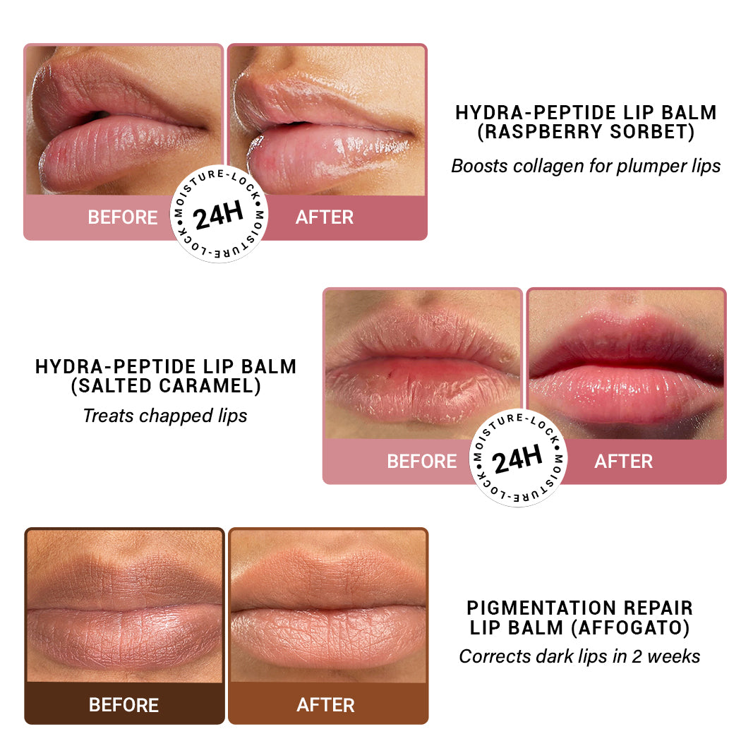 Lips Don't Lie Kit | Lip Balm Combo