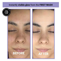 skin-clean-best-facewash