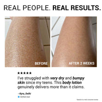 Hydra-Repair 10% Urea and Avocado Oil Body Lotion