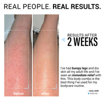 48hr Dry Skin Relief Body Wash & Body Lotion Travel Combo with Urea Treatment