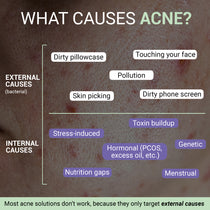 Anti-Acne Advanced Detox Kit