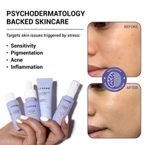 Bestsellers 4 Step Kit Before and After