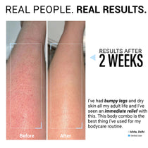 48hr Dry Skin Relief Body Wash & Body Lotion Combo with Urea Treatment