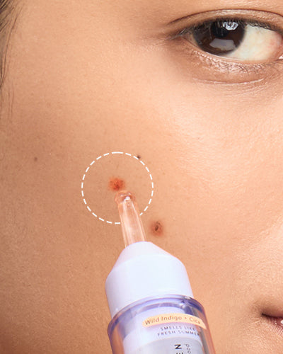 Dark Spot