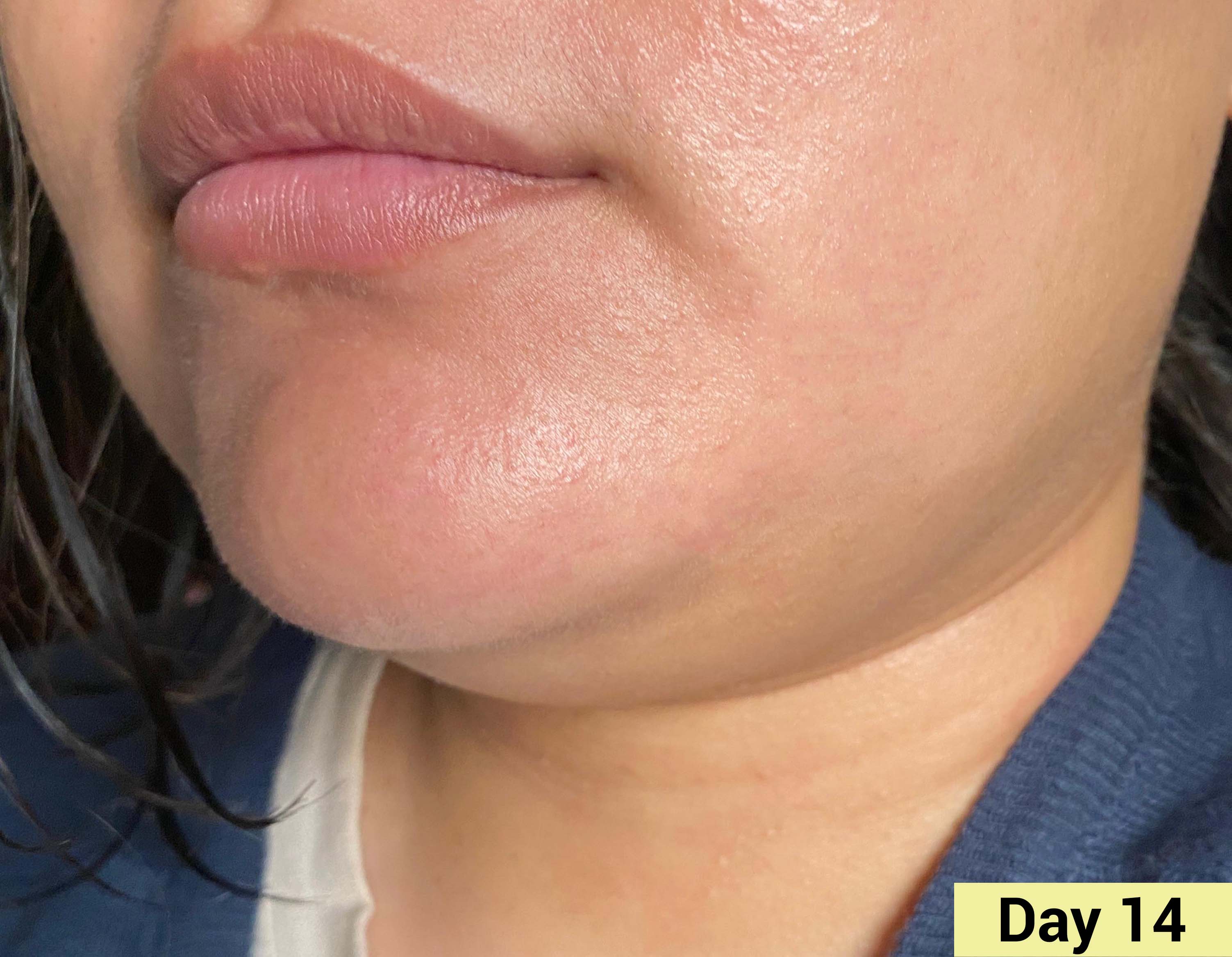 Real People. Real Results.