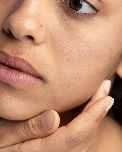 Dull Skin