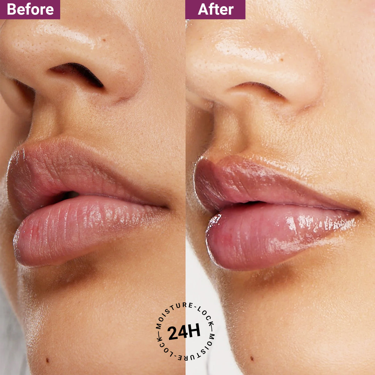 before and after sereko lip balm