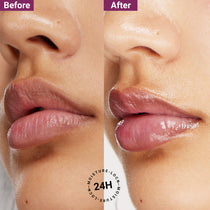 before and after sereko lip balm