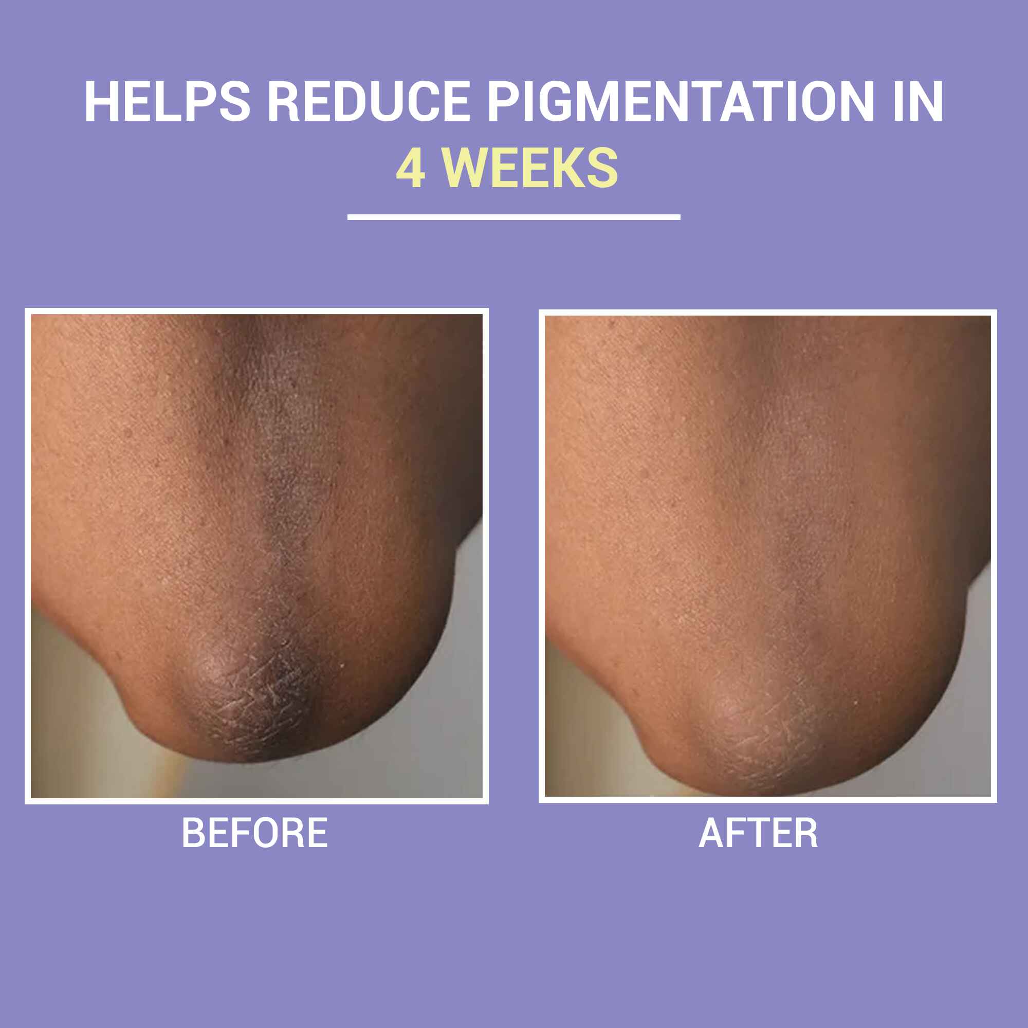 Clarifying Body Scrub After Before Image